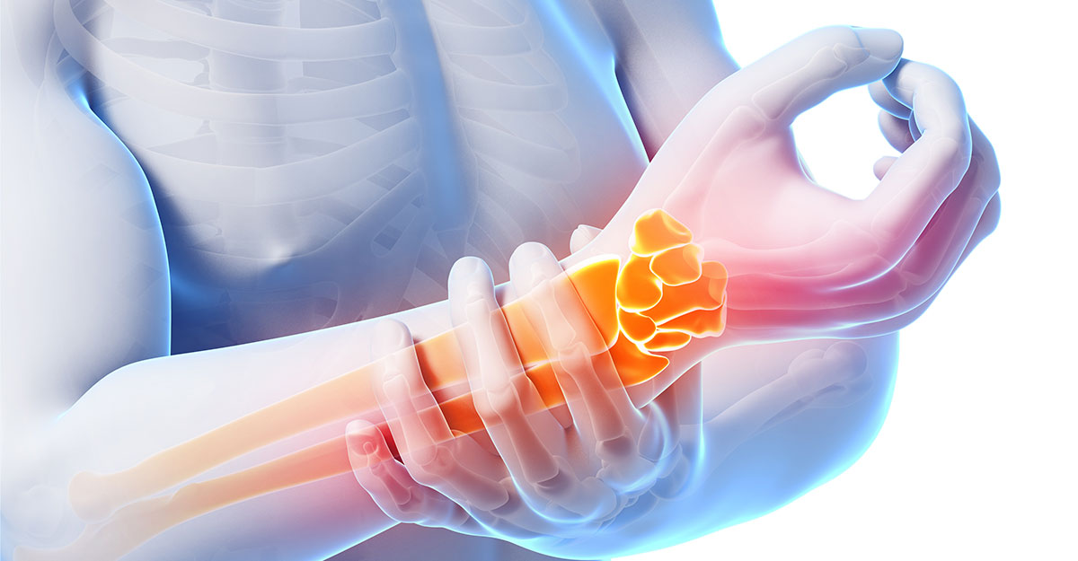 Anchorage natural carpal tunnel treatment